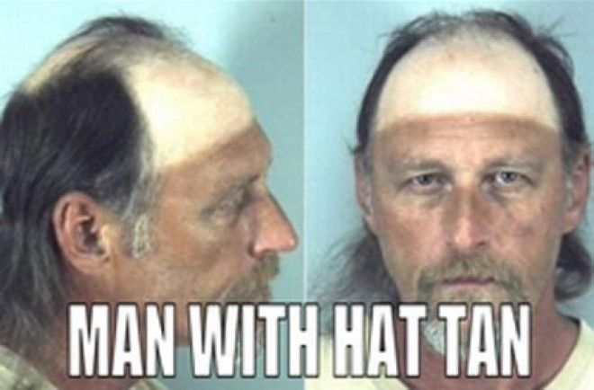 hat tan line