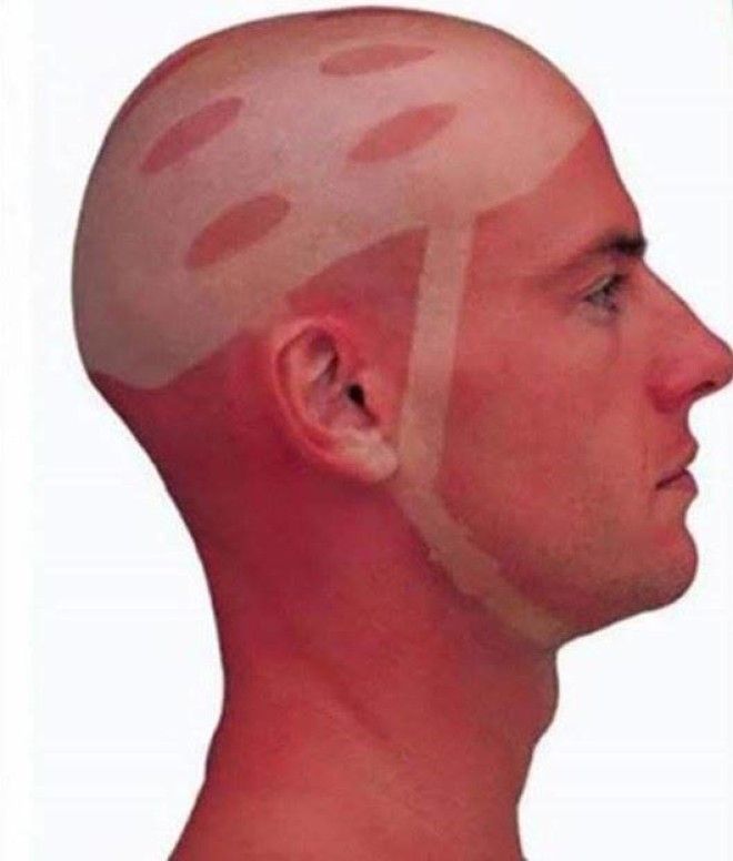 abbronzature assurde