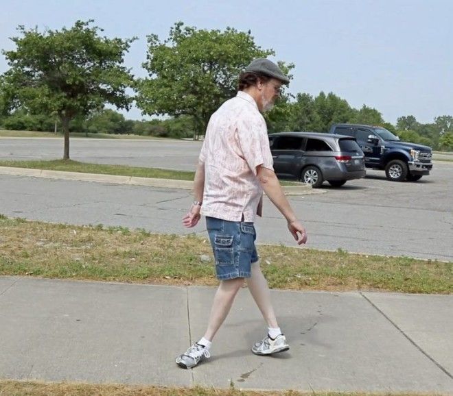 "Мистер Эластик" выворачивает ноги на 180 градусов и продолжает спокойно ходить