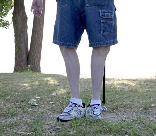 "Мистер Эластик" выворачивает ноги на 180 градусов и продолжает спокойно ходить