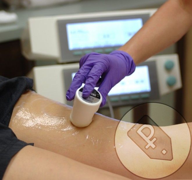 Интересные факты об эпиляции