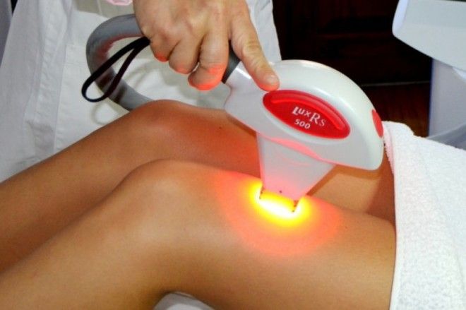 Интересные факты об эпиляции