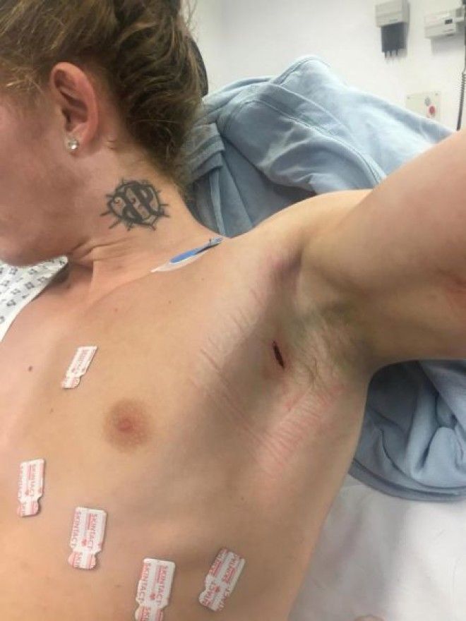 Восьмеро гопников с ножами решили отжать телефон у парня а тот оказался бойцом ММА