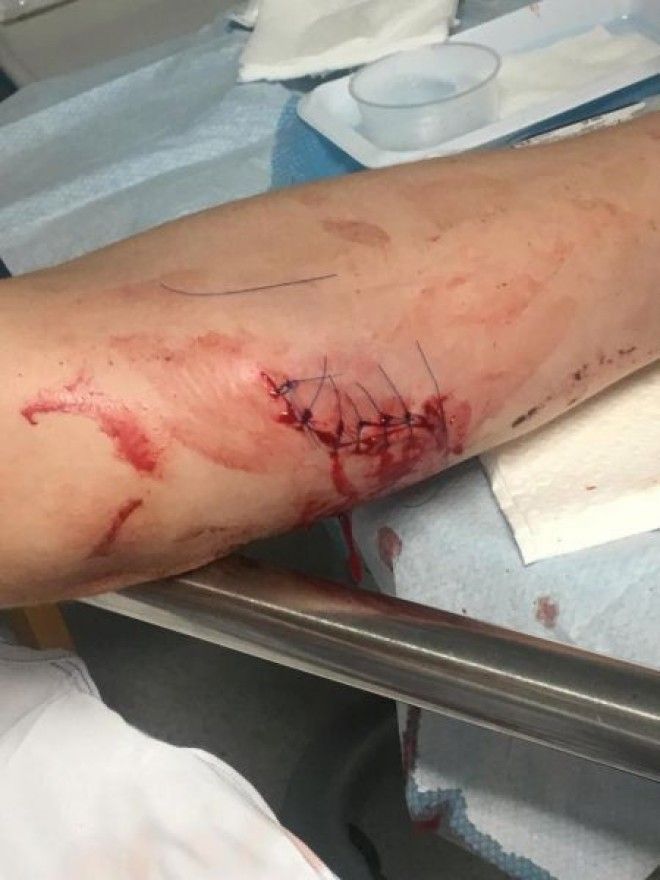 Восьмеро гопников с ножами решили отжать телефон у парня а тот оказался бойцом ММА