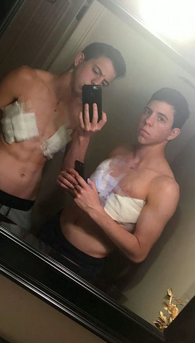 Сестры-близняшки стали парнями, но без хозяйства