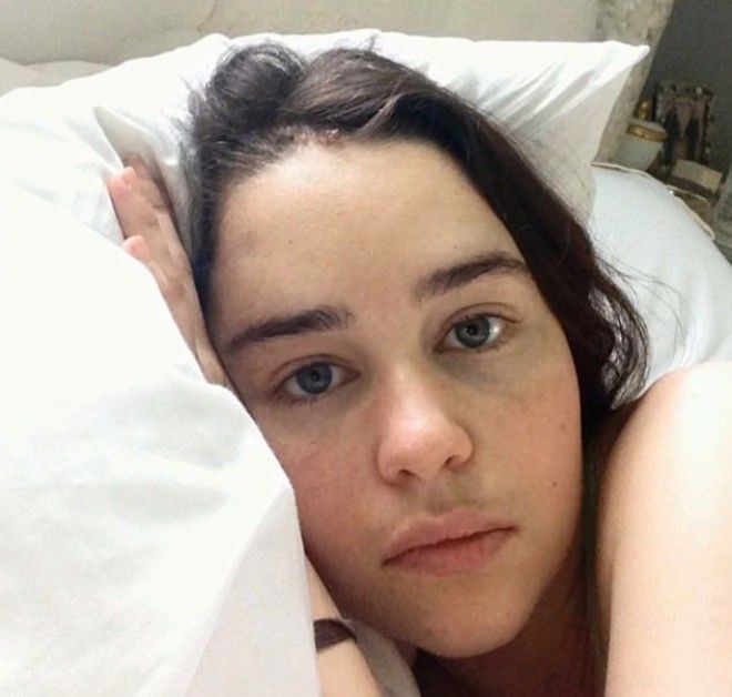 Эмилия Кларк показала как она выглядела после инсульта