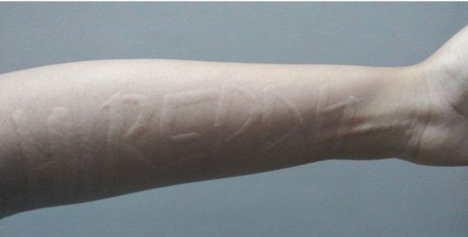 16 человек, которым природа подарила тело с особенностями