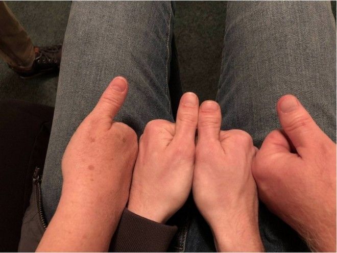 16 человек, которым природа подарила тело с особенностями