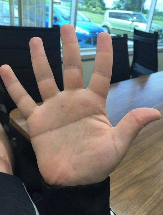 16 человек, которым природа подарила тело с особенностями