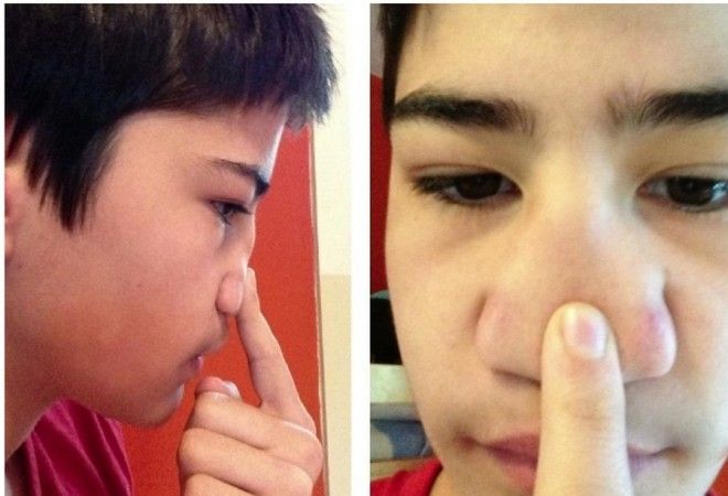 16 человек, которым природа подарила тело с особенностями