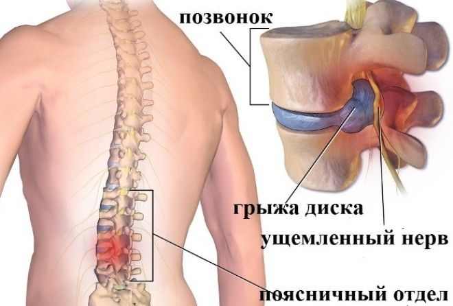 Через 6 месяцев все исчезло!