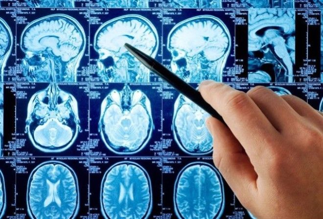 Был обнаружен отдел мозга, который отвечает за связь с высшим разумом