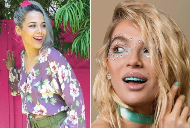 Белоснежная улыбка вышла из моды