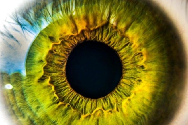 Многие люди страдают расстройствами зрения в течение всей жизни.